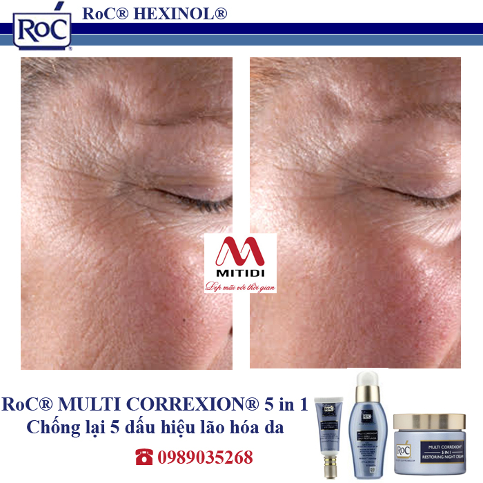 Kem RoC Multi Correxion 5 in 1 Mitidi-chong-lao-hoa-xoa-nep-nhan-16.jpg (325 KB)